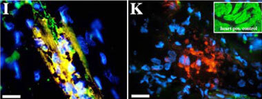 Heart muscle cells